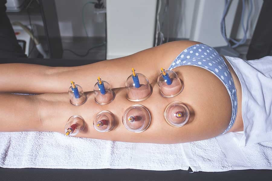 WHAT DOES CUPPING THERAPY DO FOR YOU